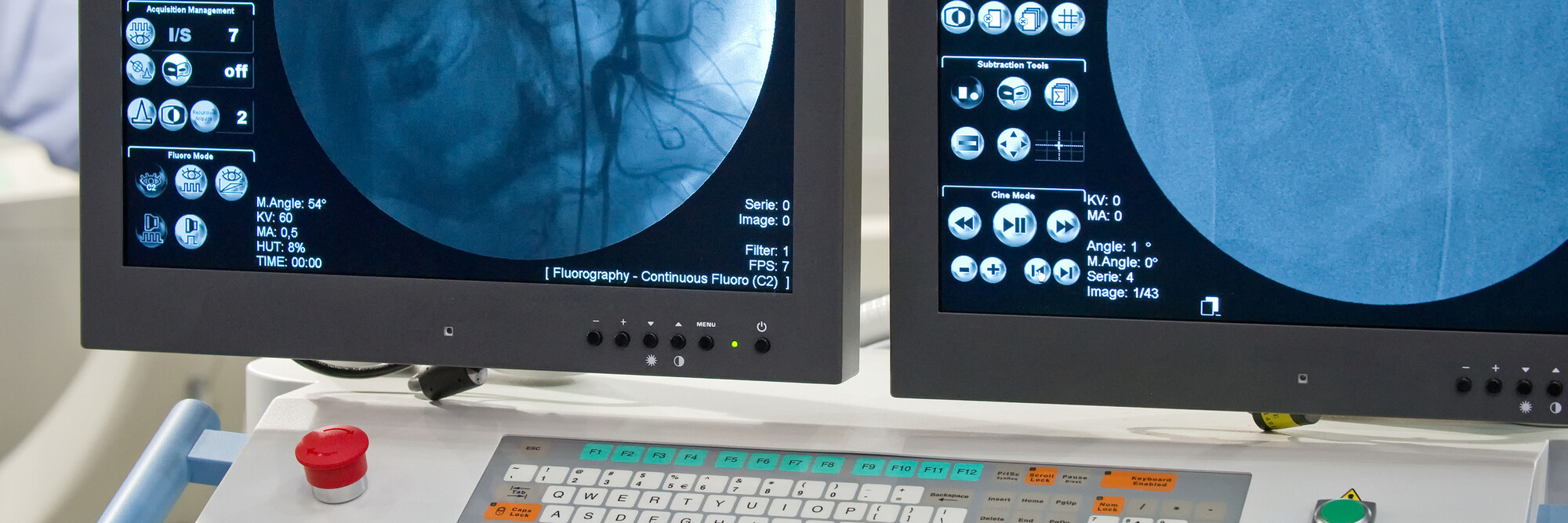 Eine Angiografie - eine radiologische Darstellung von Blutgefäßen - auf zwei Monitoren.
