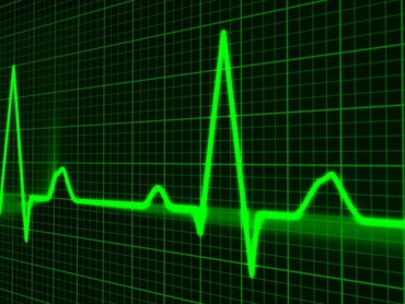 Eine EKG Kurse (Puls).