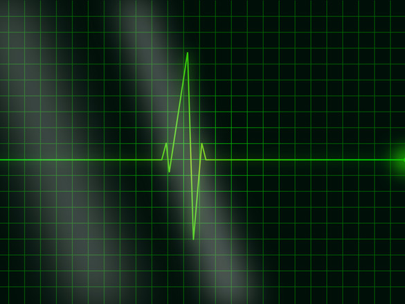 Stilisierte Kurve eines EKG.
