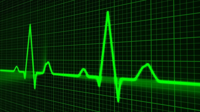 Eine EKG Kurse (Puls).