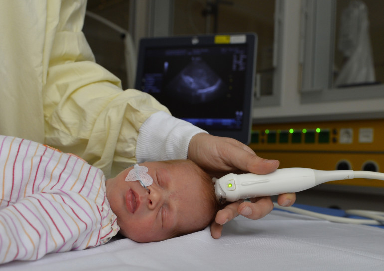 Schlafender Säugling bei einer Ultraschalluntersuchung.